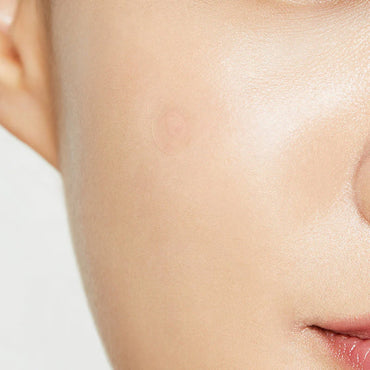 COSRX Clear Fit Master Patch ultradünn zur Behandlung von Unreinheiten